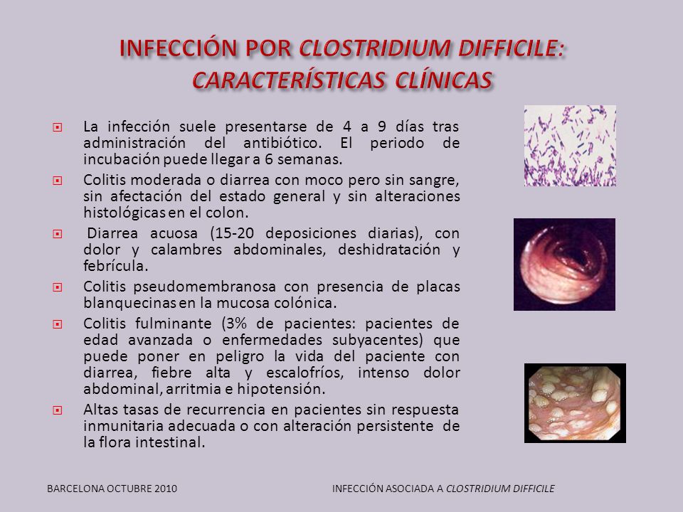 infeccion clostridium infeccion clostridium